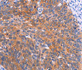 PTPN13 Polyclonal Antibody – Figure 1 of 3