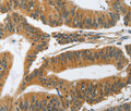 PIK3R3 Polyclonal Antibody – Figure 1 of 3