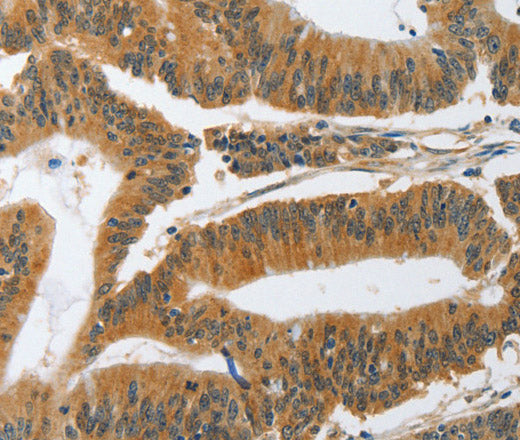 PIK3R3 Polyclonal Antibody – Figure 1 of 3