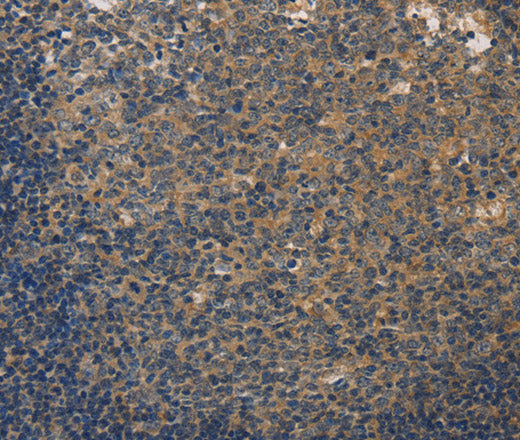 DUSP26 Polyclonal Antibody – Figure 1 of 3