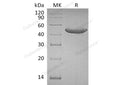Recombinant Human GITR/TNFRSF18 Protein (Fc Tag) – Figure 1 of 2