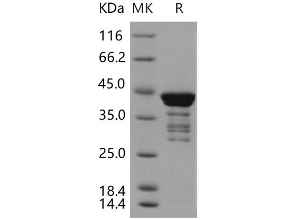 Recombinant Human C1D Protein (GST Tag) – Figure 1 of 2