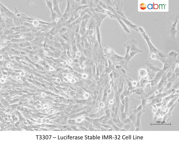 SK-N-AS Stably Overexpresisng THAP1 F81L  - Clone 35 – Figure 1 of 1