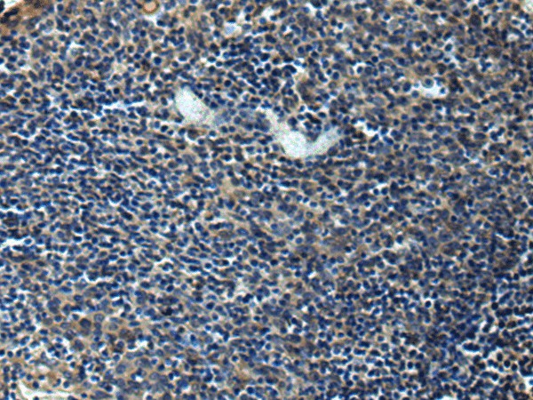 ERLIN1 Polyclonal Antibody – Figure 1 of 3