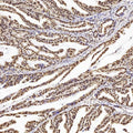 PTEN Polyclonal Antibody – Figure 1 of 4