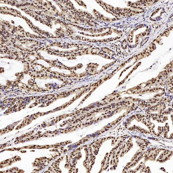 PTEN Polyclonal Antibody – Figure 1 of 4