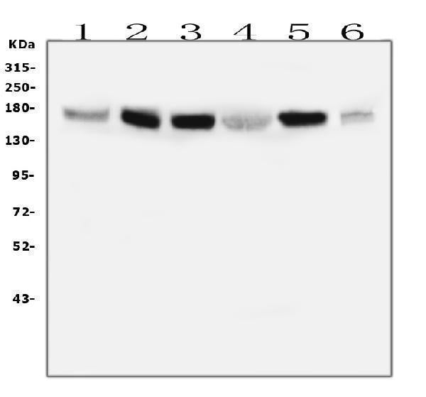 Anti-IRS1 Antibody Picoband® (monoclonal, 10I3)