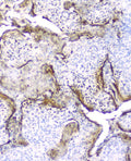 Anti-Elafin/Skalp PI3 Antibody  (monoclonal, C7)