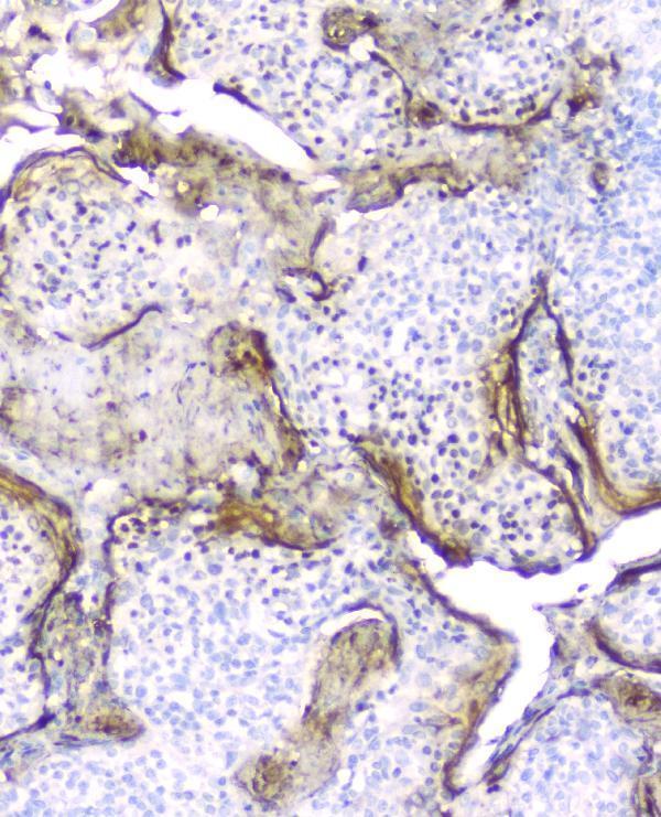 Anti-Elafin/Skalp PI3 Antibody  (monoclonal, C7)