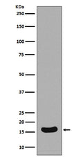 Anti-Survivin Birc5 Rabbit Monoclonal Antibody