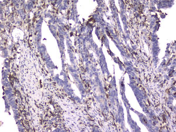 Anti-CD18 ITGB2 Antibody Picoband® (monoclonal, 1A3/2A10)