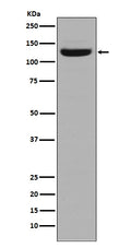 Anti-Collagen I COL1A1 Rabbit Monoclonal Antibody