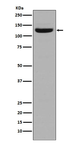 Anti-Collagen I COL1A1 Rabbit Monoclonal Antibody