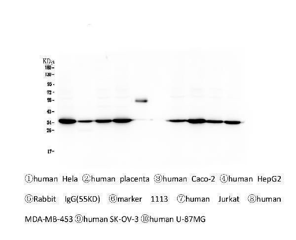 Anti-Emerin EMD Antibody Picoband® (monoclonal, 5A10)