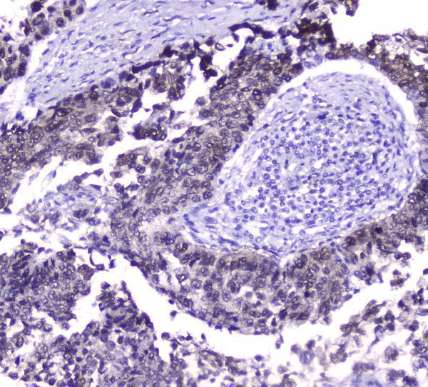 Anti-Hsp70 HSPA1A Antibody Picoband® (monoclonal, 3H5)