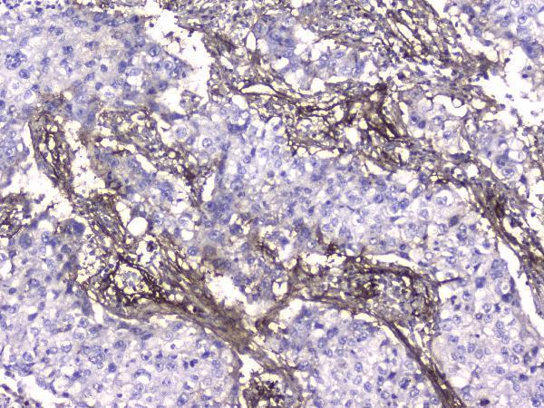 Anti-Collagen IV COL4A1 Antibody Picoband® (monoclonal, 3G3)