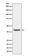 Anti-HDAC8/Histone Deacetylase 8 Rabbit Monoclonal Antibody