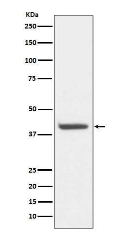 Anti-HDAC8/Histone Deacetylase 8 Rabbit Monoclonal Antibody