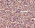 Anti-beta III Tubulin TUBB3 Rabbit Monoclonal Antibody