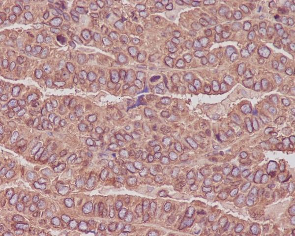 Anti-beta III Tubulin TUBB3 Rabbit Monoclonal Antibody