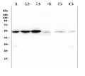 Anti-Desmin Antibody Picoband® (monoclonal, 2B5)