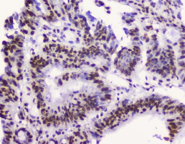 Anti-RbAp48 RBBP4 Antibody Picoband® (monoclonal, 9F3)
