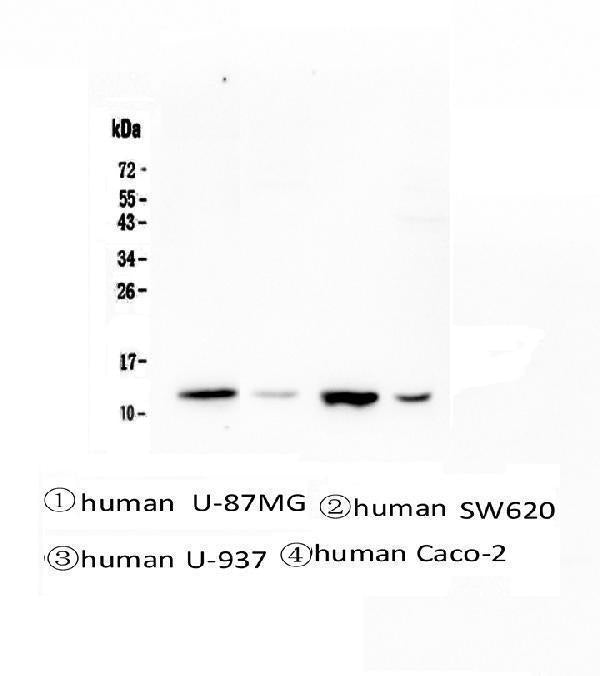 Anti-Stefin B CSTB Antibody Picoband® (monoclonal, 2B6)