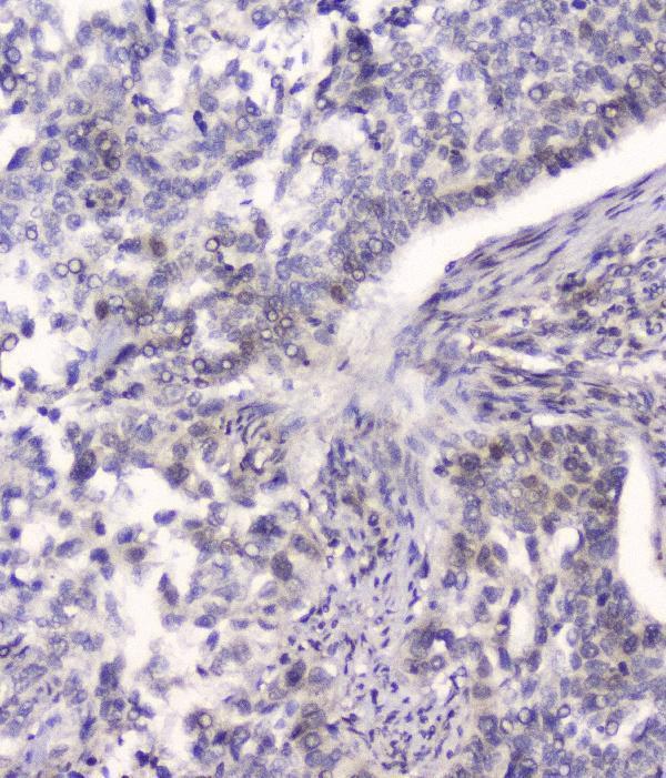 Anti-HSPA2 Antibody Picoband® (monoclonal, 4A4)