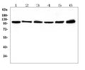 Anti-Hsp105/HSPH1 Antibody Picoband® (monoclonal, 3D10)