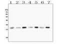Anti-Cofilin 2/CFL2 Antibody Picoband® (monoclonal, 8C13)
