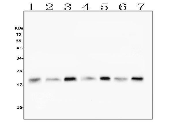 Anti-Cofilin 2/CFL2 Antibody Picoband® (monoclonal, 8C13)