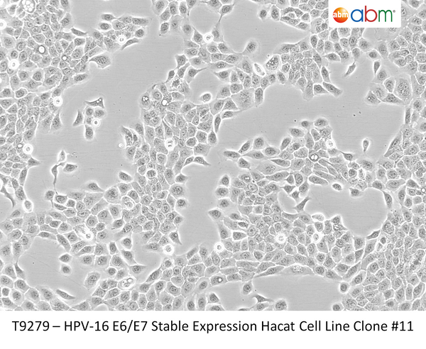 HPV-16 E6/E7 Stable Expression Hacat Cell Line Clone #11 | Applied Biological Materials (abm)