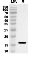 Western blot analysis was performed using anti-Mouse VSTM2A polyclonal antibody at 1ug/mL on recombinant Mouse VSTM2A (Catalog No. MA002012).