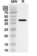 Western blot analysis was performed using anti-Mouse Timd2/G9D3 protein polyclonal antibody at 1ug/mL on recombinant Mouse Timd2/G9D3 protein (Catalog No. MA149012).