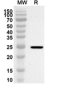 Western blot analysis was performed using anti-Mouse TARM1 polyclonal antibody at 1ug/mL on recombinant Mouse TARM1 (Catalog No. MA224012).
