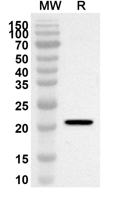 Western blot analysis was performed using anti-Mouse EPHA6 polyclonal antibody at 1ug/mL on recombinant Mouse EPHA6 (Catalog No. MA231012).