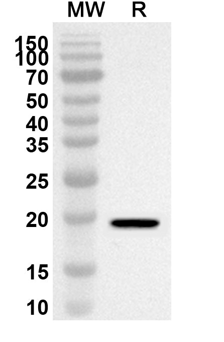 Western blot analysis was performed using anti-Mouse Clec4b2 polyclonal antibody at 1ug/mL on recombinant Mouse Clec4b2 (Catalog No. MA233012).