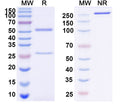 SDS-PAGE for Anti-Mouse TMEM87A Monoclonal Antibody (1A230)