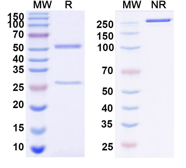 SDS-PAGE for Anti-Mouse TMEM87A Monoclonal Antibody (1A230)