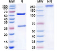 SDS-PAGE for Anti-Mouse TMEM87A Monoclonal Antibody (1A231)
