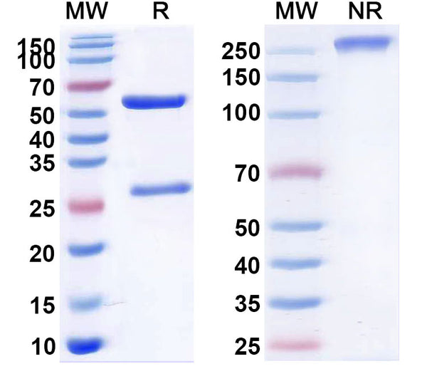 SDS-PAGE for Anti-Mouse TMEM87A Monoclonal Antibody (1A231)