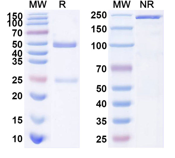 SDS-PAGE for Anti-Mouse TMEM87A Monoclonal Antibody (1A232)