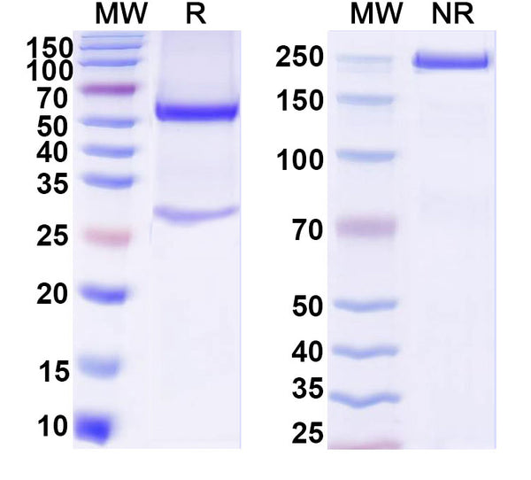 SDS-PAGE for Anti-Mouse NRN1/Neuritin Monoclonal Antibody (1A440)