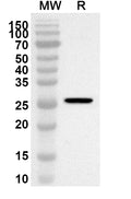 Western blot analysis was performed using anti-Mouse JAML polyclonal antibody at 1ug/mL on recombinant Mouse JAML (Catalog No. MA359012).