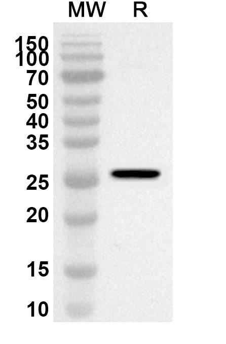 Western blot analysis was performed using anti-Mouse JAML polyclonal antibody at 1ug/mL on recombinant Mouse JAML (Catalog No. MA359012).