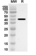 Western blot analysis was performed using anti-Mouse SMOC2 polyclonal antibody at 1ug/mL on recombinant Mouse SMOC2 (Catalog No. MA372012).