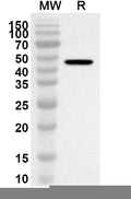 Western blot analysis was performed using anti-Mouse CHST3 polyclonal antibody at 1ug/mL on recombinant Mouse CHST3 (Catalog No. MA375012).