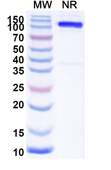 SDS-PAGE for Anti-Mouse Mu-type opioid receptor/OPRM1/μOR Nanobody (SAA2285)