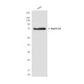 Western blot detection of HSPA1A in Hela&HsHela cell lysates using HSP70 antibody (1:1000 diluted) .