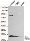 Western blot detection of RAB2A in Hela, Ramos&K562 cell lysates and using RAB2A antibody (1:800 diluted) .
